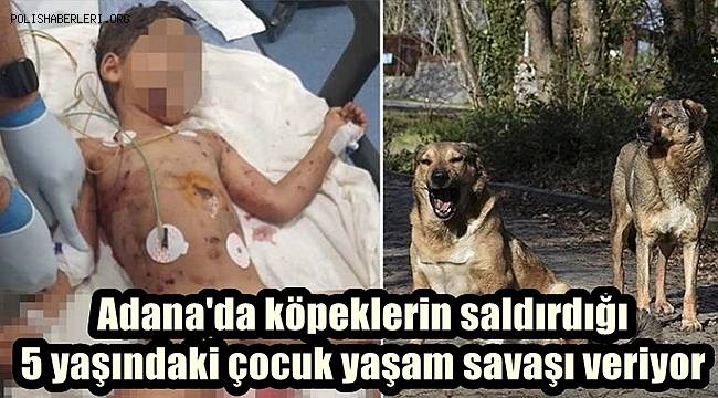 Adana'da köpeklerin saldırdığı 5 yaşındaki çocuk yaşam savaşı veriyor 