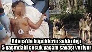 Adana'da köpeklerin saldırdığı 5 yaşındaki çocuk yaşam savaşı veriyor 